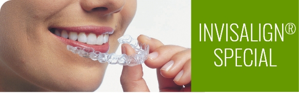 Woman putting in invisalign aligners